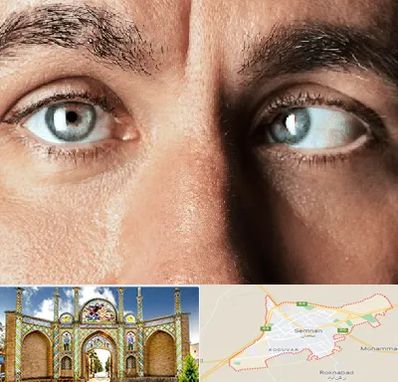 فوق تخصص استرابیسم در سمنان