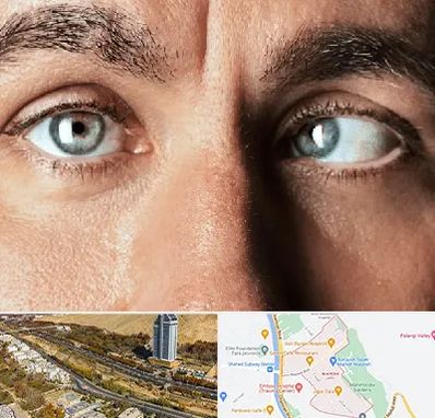 فوق تخصص استرابیسم در خیابان نیایش شیراز