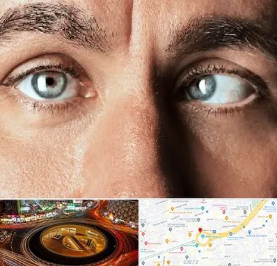 فوق تخصص استرابیسم در میدان ولیعصر 