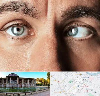 فوق تخصص استرابیسم در عفیف آباد شیراز