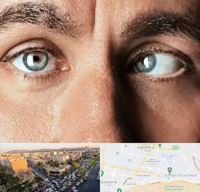 فوق تخصص استرابیسم در تهرانپارس 