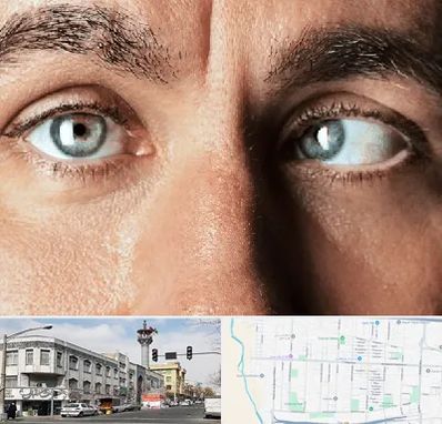 فوق تخصص استرابیسم در 17شهریور