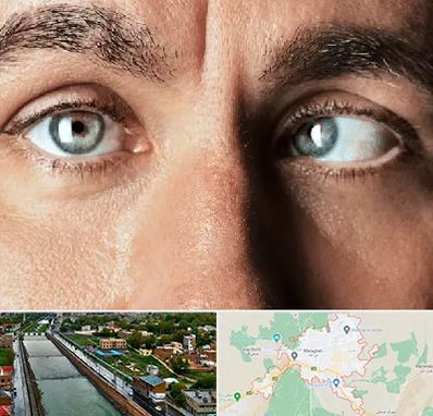 فوق تخصص استرابیسم در مراغه