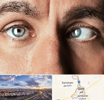 فوق تخصص استرابیسم در قم