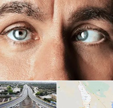 فوق تخصص استرابیسم در اندیمشک