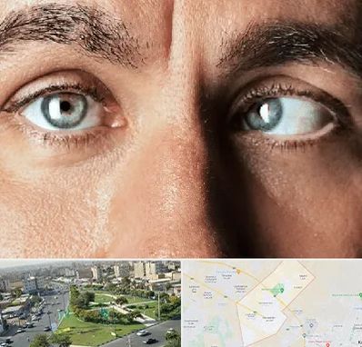 فوق تخصص استرابیسم در کمال شهر کرج 