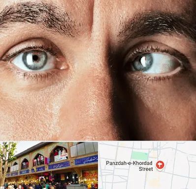 فوق تخصص استرابیسم در 15 خرداد
