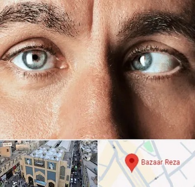فوق تخصص استرابیسم در بازار رضا مشهد