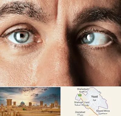 فوق تخصص استرابیسم در یزد