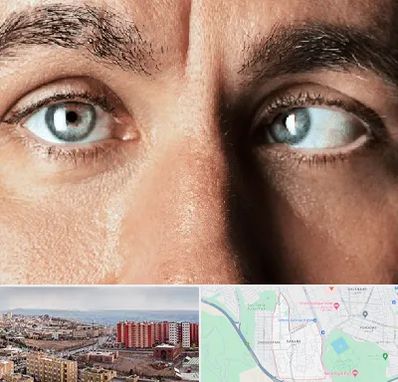 فوق تخصص استرابیسم در سهند تبریز