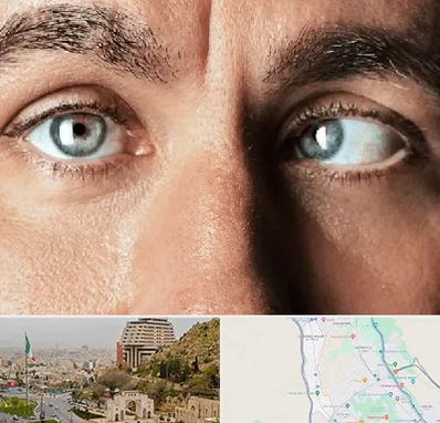 فوق تخصص استرابیسم در فرهنگ شهر شیراز