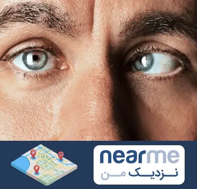 فوق تخصص استرابیسم در نزدیک من