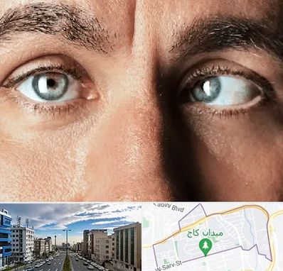 فوق تخصص استرابیسم در سعادت آباد 