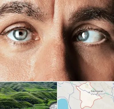 فوق تخصص استرابیسم در گچساران