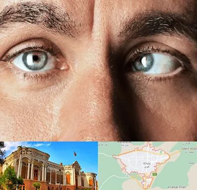 فوق تخصص استرابیسم در خوی