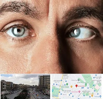 فوق تخصص استرابیسم در بلوار فردوسی مشهد 