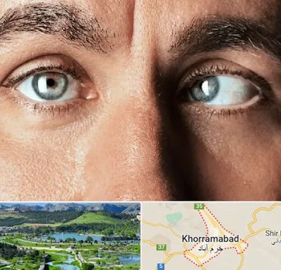 فوق تخصص استرابیسم در خرم آباد