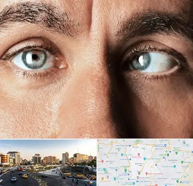 فوق تخصص استرابیسم در منطقه 7 تهران 