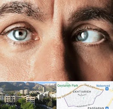 فوق تخصص استرابیسم در اختیاریه 