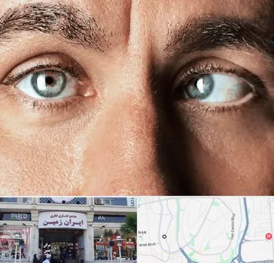 فوق تخصص استرابیسم در ایران زمین