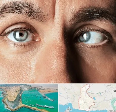 فوق تخصص استرابیسم در سیستان و بلوچستان