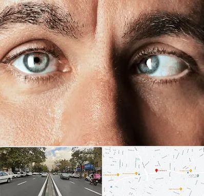 فوق تخصص استرابیسم در دولت 