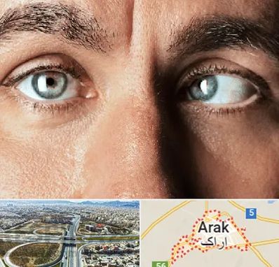 فوق تخصص استرابیسم در اراک