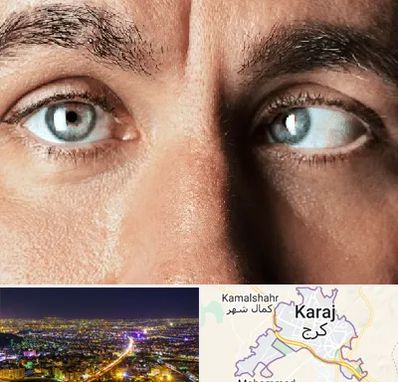 فوق تخصص استرابیسم در کرج