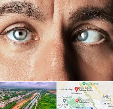 فوق تخصص استرابیسم در قصرالدشت شیراز