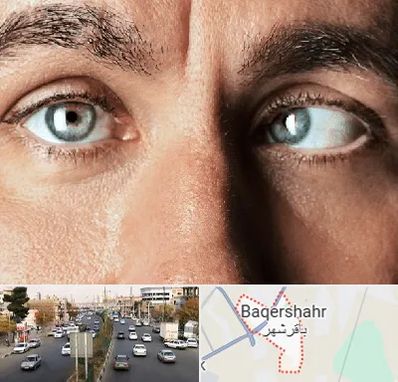 فوق تخصص استرابیسم در باقرشهر