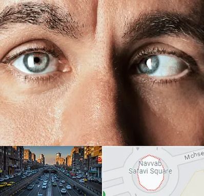 فوق تخصص استرابیسم در نواب