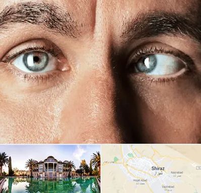 فوق تخصص استرابیسم در شیراز