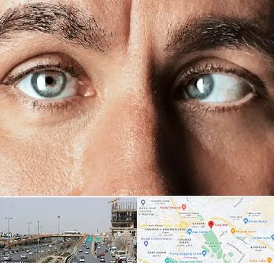 فوق تخصص استرابیسم در بلوار توس مشهد 