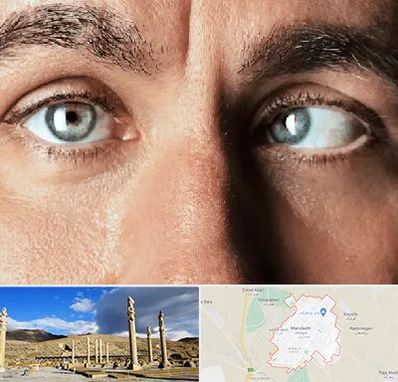 فوق تخصص استرابیسم در مرودشت