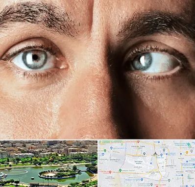 فوق تخصص استرابیسم در منطقه 9 تهران 