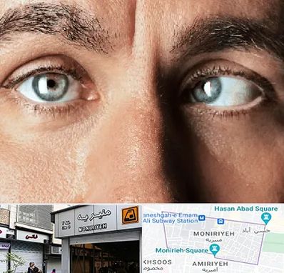 فوق تخصص استرابیسم در منیریه 