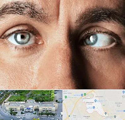 فوق تخصص استرابیسم در نسیم شهر