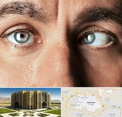 فوق تخصص استرابیسم در نجف آباد