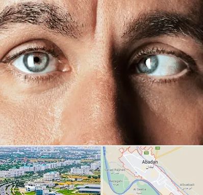 فوق تخصص استرابیسم در آبادان