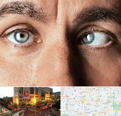 فوق تخصص استرابیسم در جنت آباد تهران 