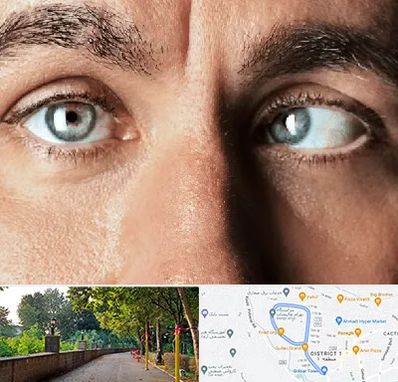 فوق تخصص استرابیسم در بلوار گیلان رشت