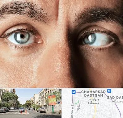 فوق تخصص استرابیسم در چهارصد دستگاه 