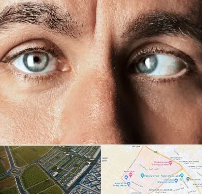 فوق تخصص استرابیسم در الهیه مشهد