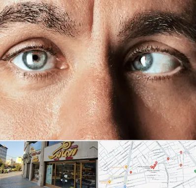 فوق تخصص استرابیسم در عطاران قم