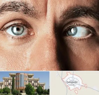 فوق تخصص استرابیسم در دهدشت