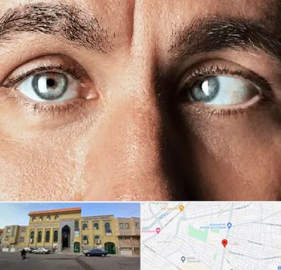 فوق تخصص استرابیسم در زنبیل آباد قم