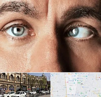 فوق تخصص استرابیسم در منطقه 11 تهران 