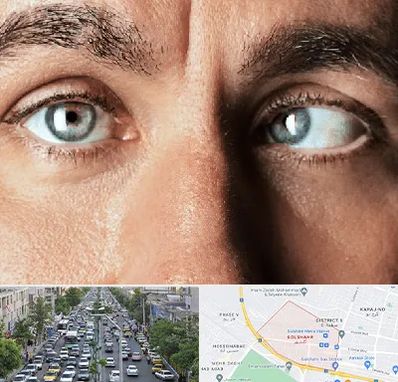 فوق تخصص استرابیسم در گلشهر کرج