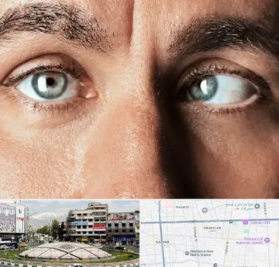 فوق تخصص استرابیسم در مرکز تهران