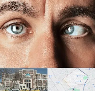 فوق تخصص استرابیسم در طلاب مشهد